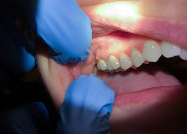 , WV Emergency Dentist Pros